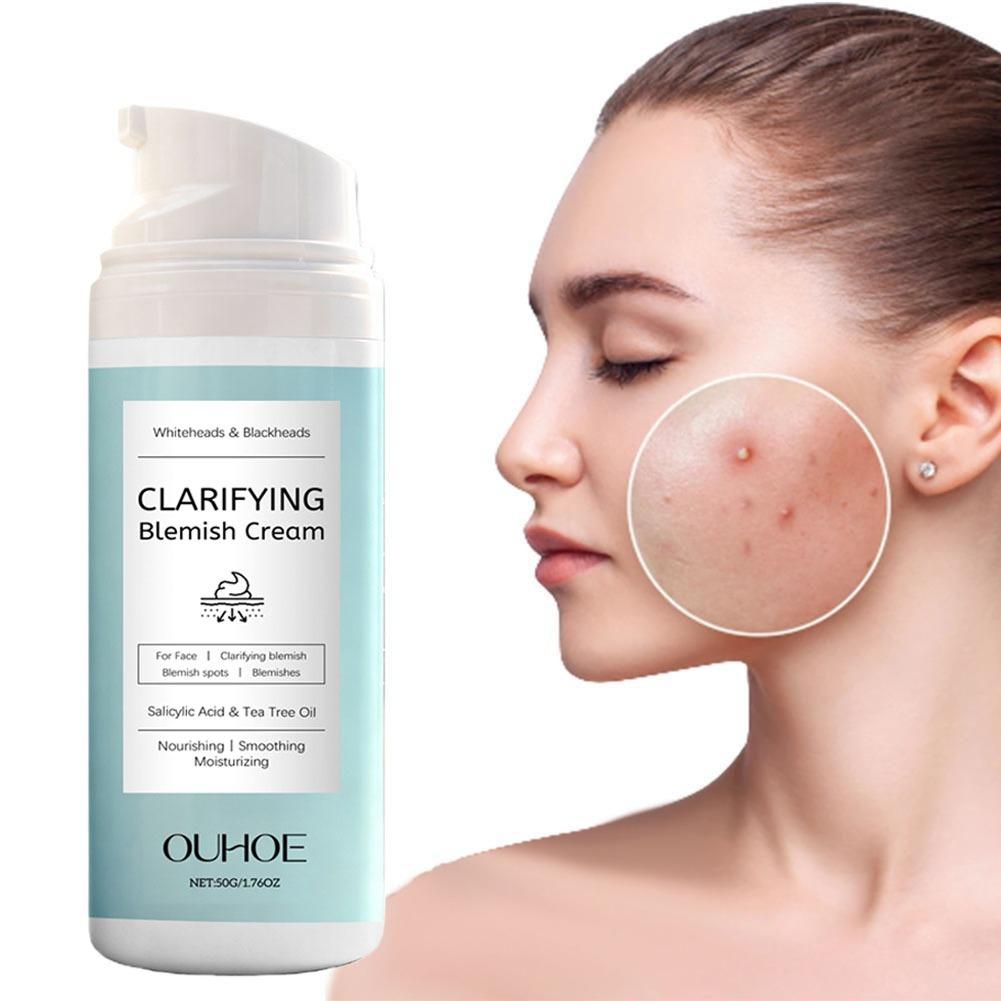 サリチル酸ニキビ除去クリーム 栄養補給 軽量 ノンオイリー  - Salicylic Acid Blackhead Remover のレビューと価格